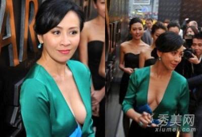 林志玲 小S… 盤點胸部下垂的女星