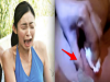 女子以為朋友身上長的是痘痘,還自願幫忙擠!結果一擠下去崩潰慘叫!沒想到那玩意兒竟然是....