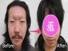 日本單眼皮大叔去割雙眼皮，就是為了徹底擺脫「猥褻臉」！沒想到「超詭異的結果」笑翻所有男女網友了 XD