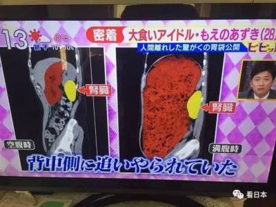 電視台公佈一張大胃王日本妹子X光照片，嚇傻了所有人！