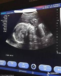 網紅曬自己懷孕6個月的照片，網友卻炸了：肚子呢？我沒懷孕肚子也比她大啊